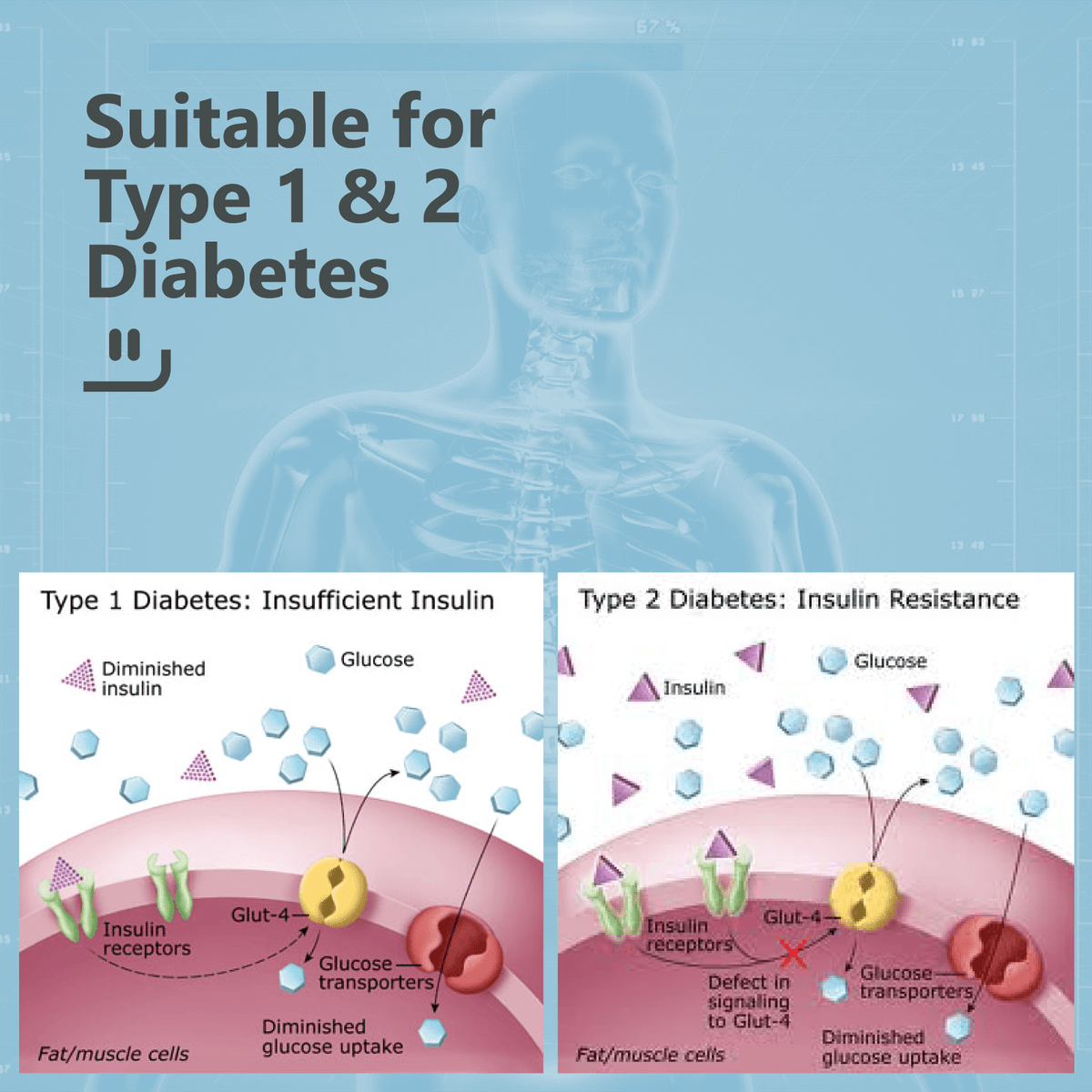 InsuJet™ Injector V5